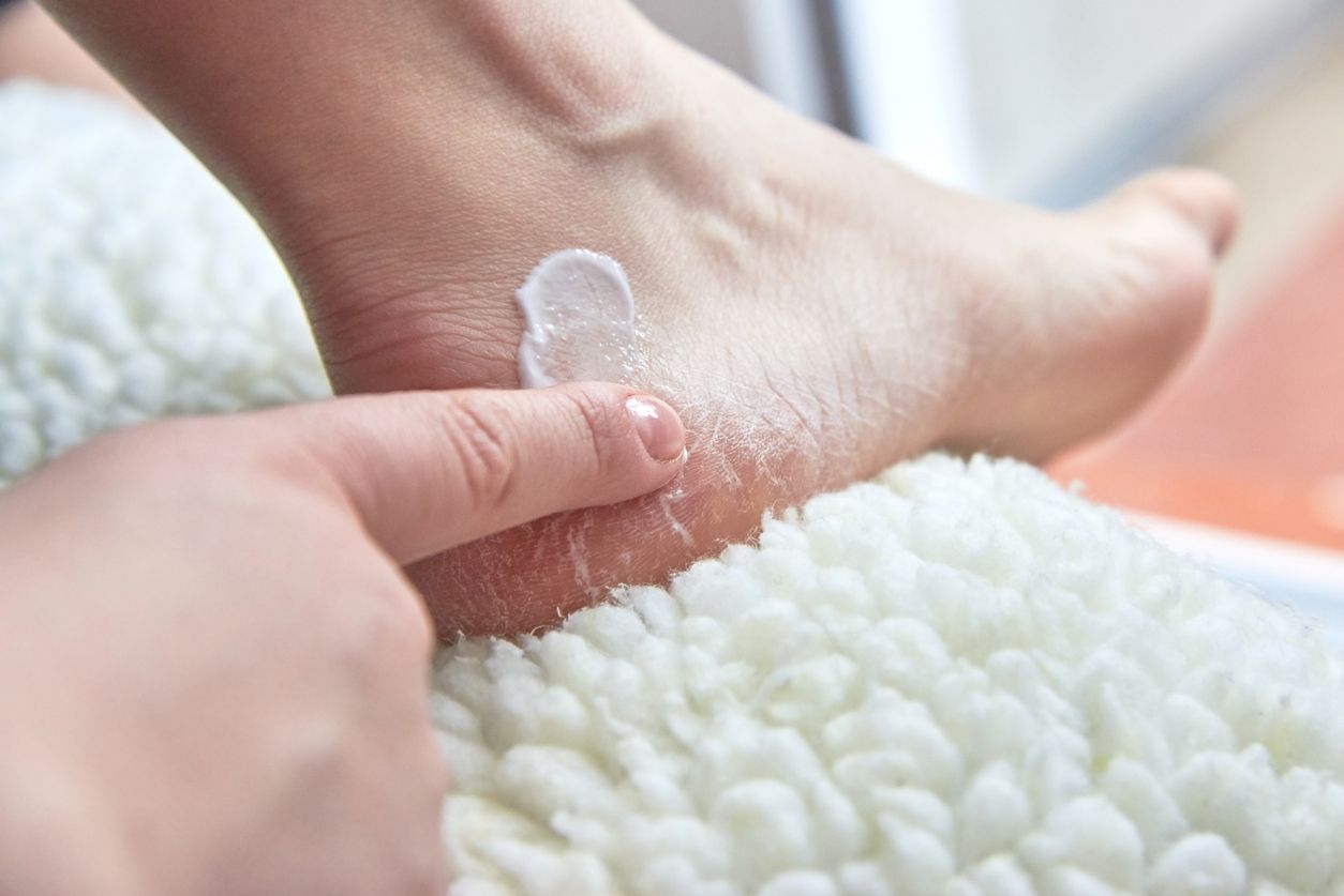 Kaki pecah-pecah menjadi salah satu masalah kaki yang berpotensi membuat perempuan kurang percaya diri. Simak penyebabnya berikut!