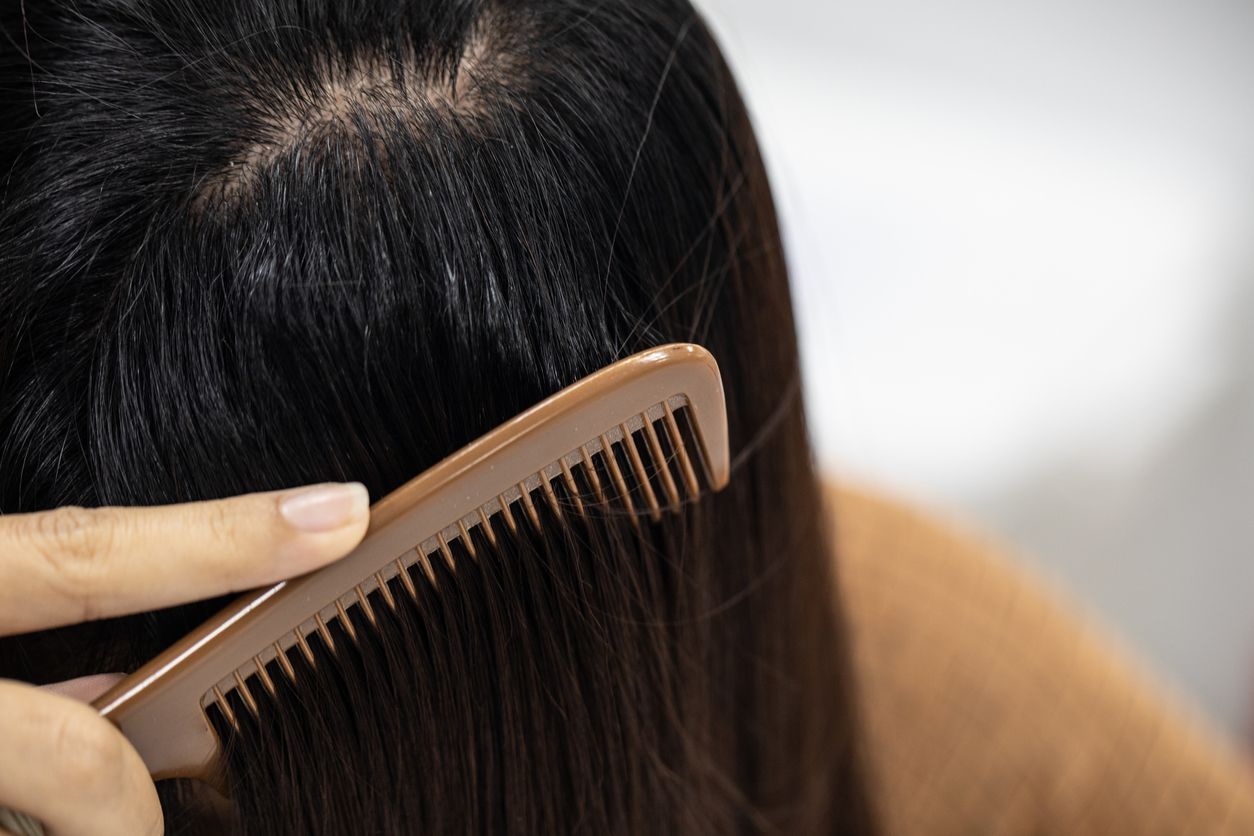 Berikut ini tiga penyebab dari rambut berminyak, mulai dari keramas terlalu sering hingga karena penggunaan produk tertentu