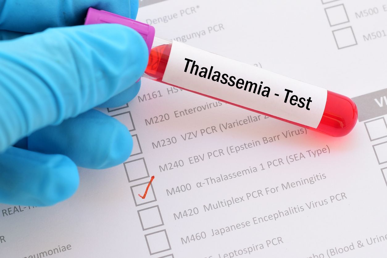 Berikut ini cara diagnosis thalasemia yang merupakan suatu kondisi kelainan darah turunan yang tengah viral di TikTok, simak selengkapnya