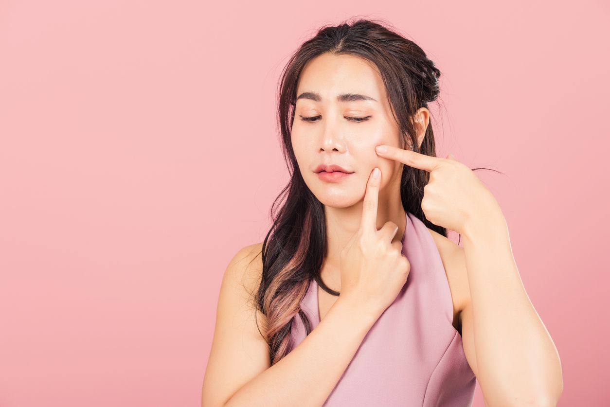 Bermanfaat baik untuk kulit, bagaimana efektivitas vitamin E untuk mengatasi masalah jerawat? Simak ulasannya!