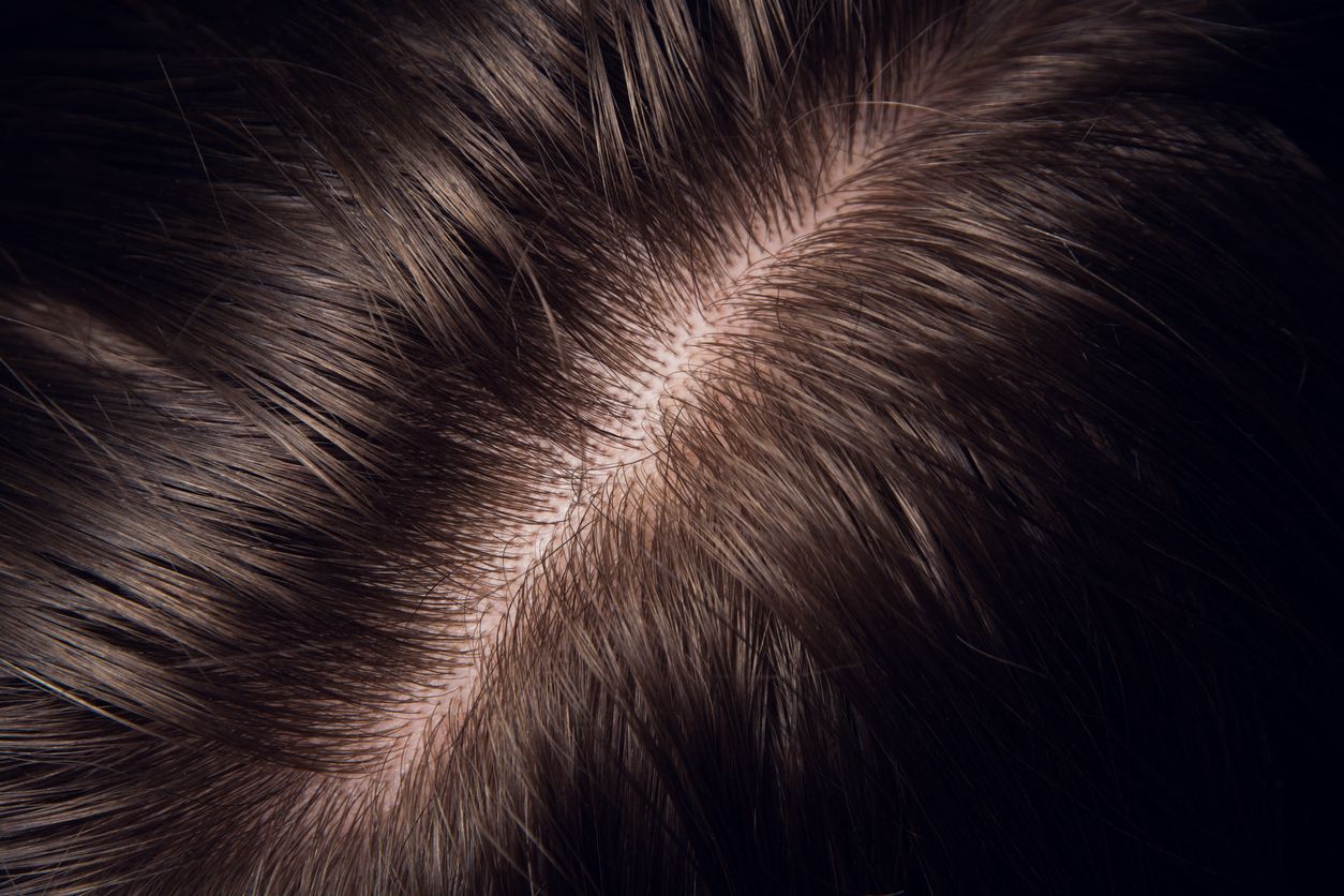 Berikut ini manfaat scrub kulit kepala, bukan hanya mengangkat kotoran saja, tapi dapat menyehatkan rambut