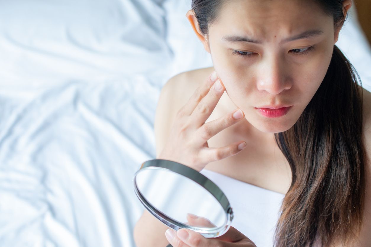 Reaksi produk kosmetik dan berbagai penyebab lain kulit sensnitif perempuan. Berikut penjelasan lengkapnya.