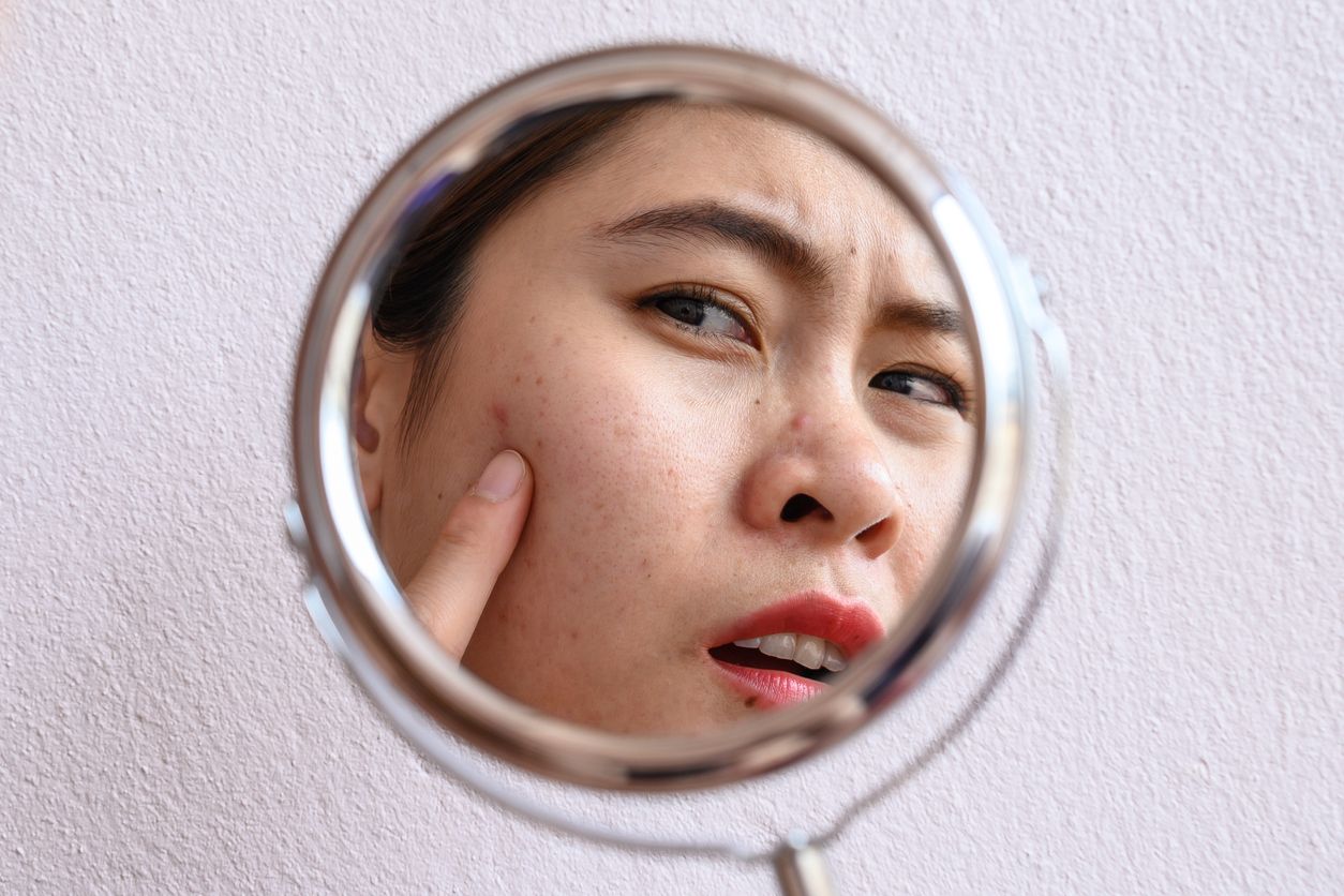 Jadi perbincangan yang viral di TikTok, berikut ini 5 tanda skin barrier rusak mulai dari kulit kering hingga muncul garis-garis halus