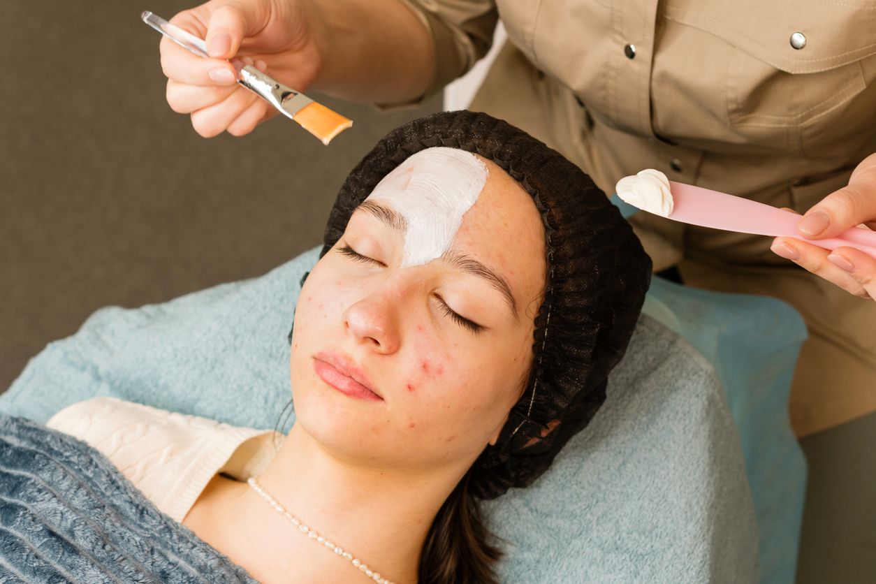 Perawatan kecantikan untuk mengatasi jerawat atau acne vulgaris berdasarkan tingkat keparahannya.