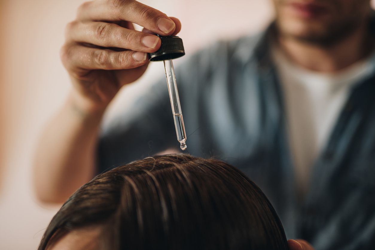 Yuk simak penjelasan mengenai  minoxidil yakni obat untuk mengatasi kerontokan rambut yang viral di TikTok