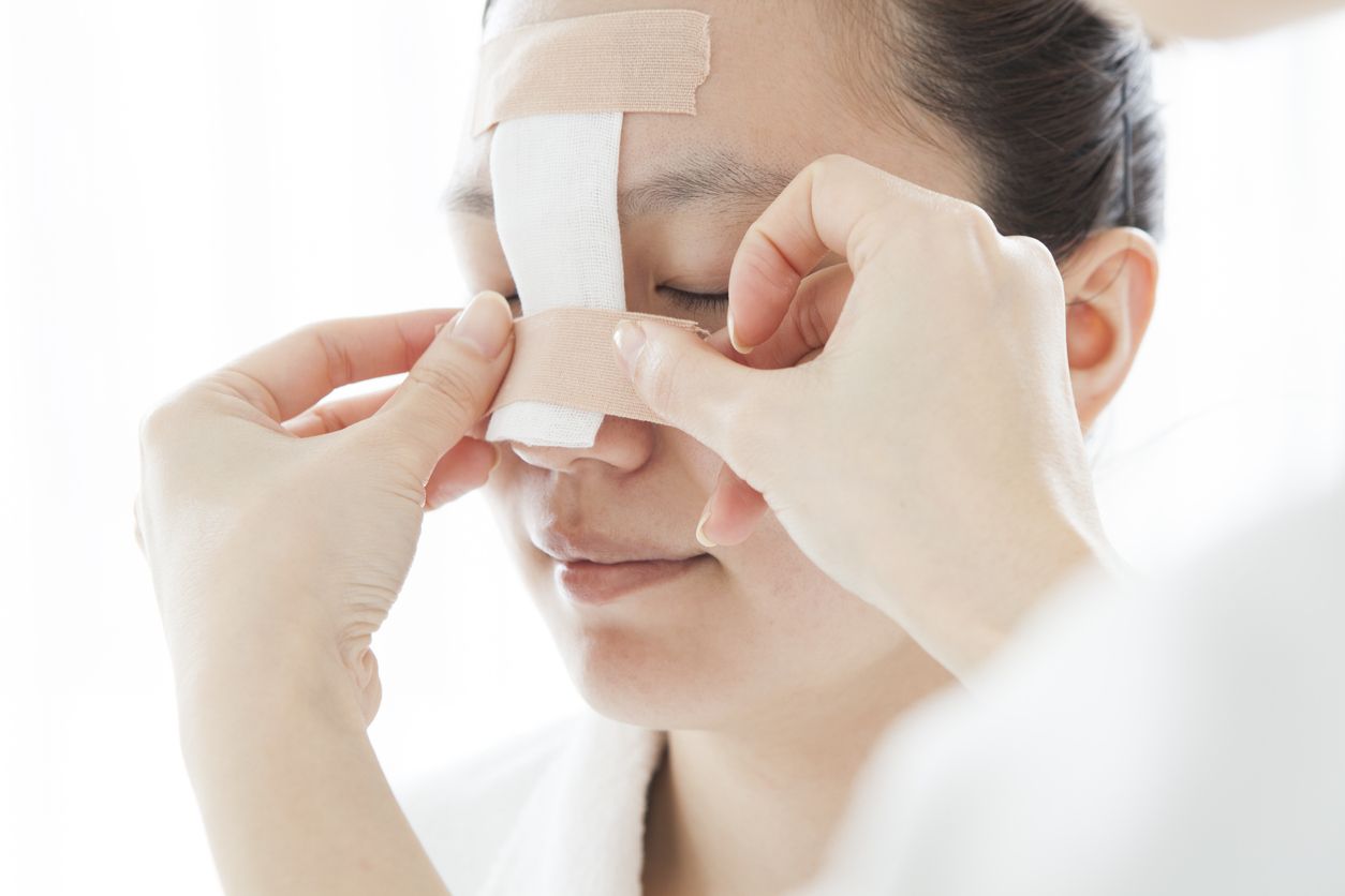 Berikut ini 5 jenis operasi plastik yang dilakukan di bagian wajah ada brow lift hingga rhinoplasty, simak selengkapnya.