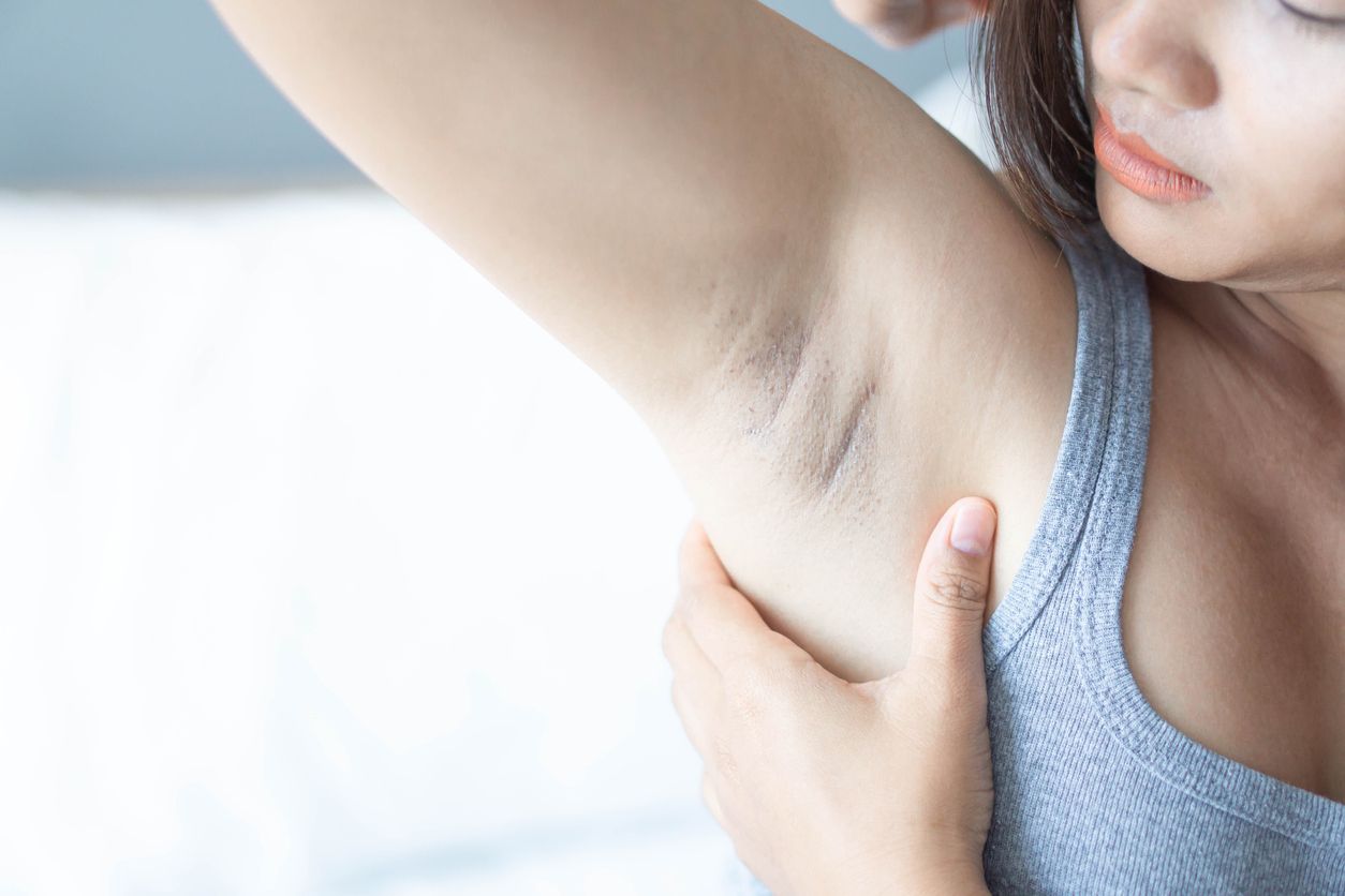Berikut ini berbagai manfaat niacinamide bagi kulit yang tak hanya sekadar mencerahkan saja, simak selengkapnya.