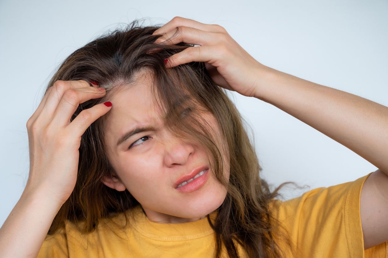 Atasi masalah ketombe dan kepala gatal dengan bahan-bahan alami yang bisa kamu jadikan masker rambut ini!