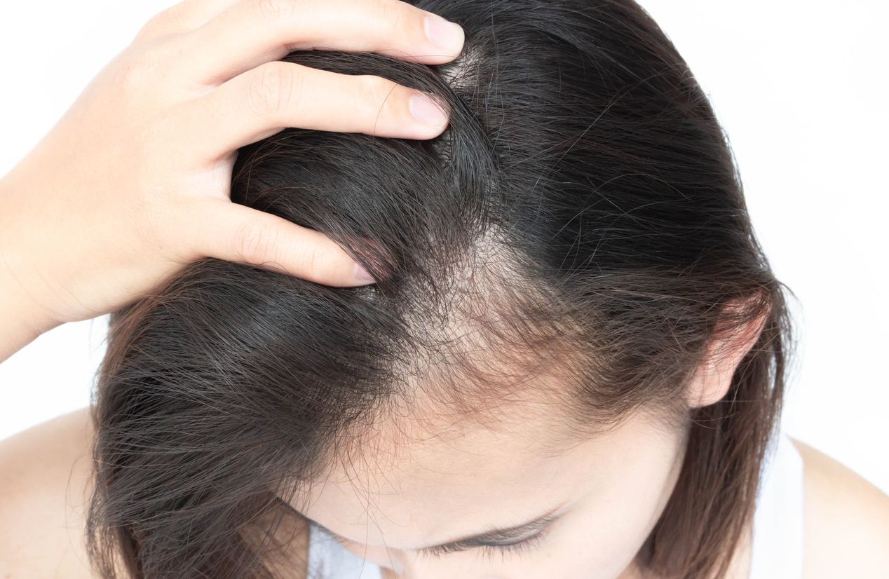 Viral di TikTok, ini ada berbagai sumber makanan untuk mengatasi masalah rambut mulai dari yang panjangnya lama hingga beruban.
