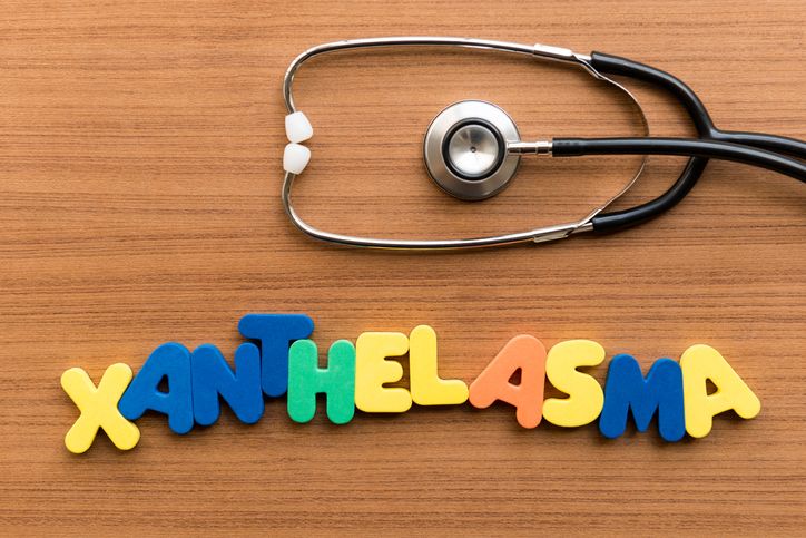 Mengenal lebih dalam apa itu xanthelasma, benjolan kuning yang berada di sudut kelopak mata. Yuk simak lengkapnya.