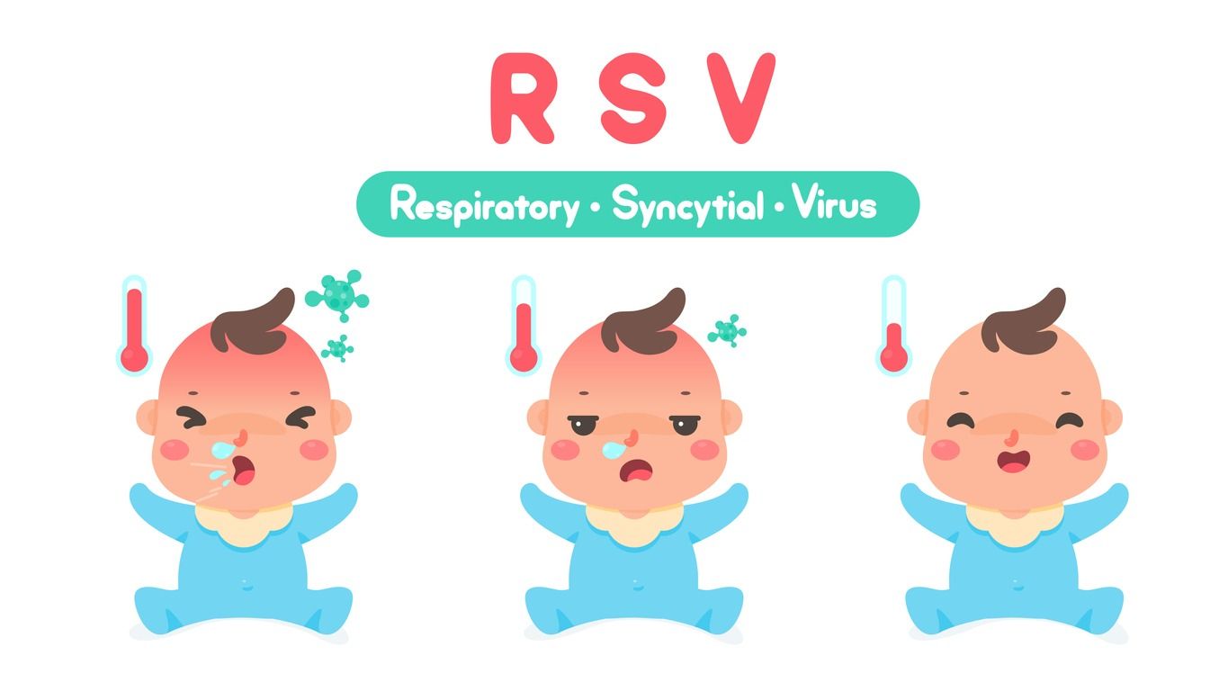 Respiratory Syncytial Virus (RSV) yang viral di TikTok menjadi penyebab utama penyakit pernapasan pada bayi, simak penjelasannya.