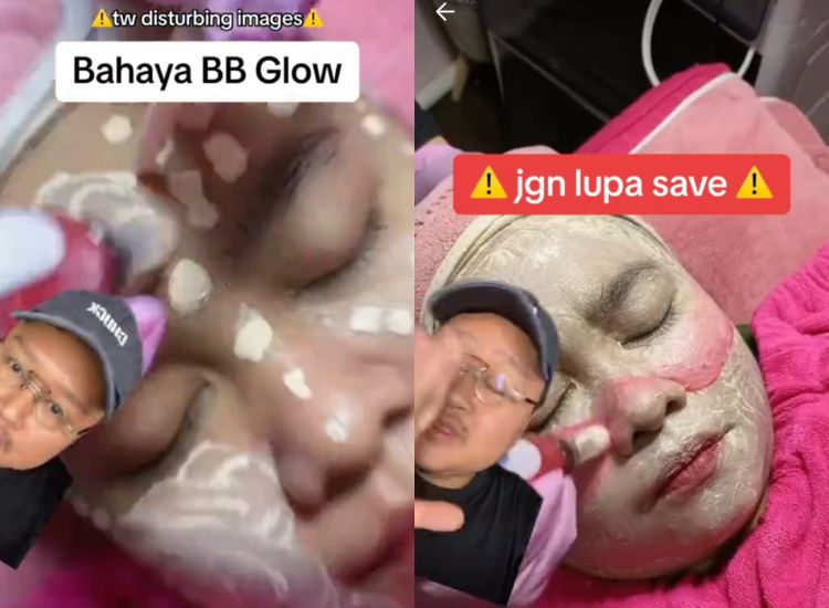 Tidak disarankan, yuk cari tahu berbagai bahaya BB glow yang lagi viral di TikTok bagi kulit. Simak penjelasan dokter selengkapnya.