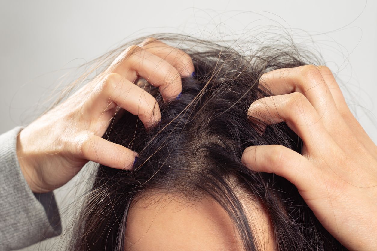 Berikut penjelasan dokter mengenai ciri-ciri tidak cocok pakai hair tonic yang viral di TikTok, simak selengkapnya.