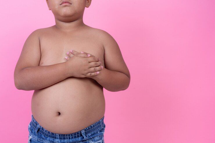 Anak gemuk sering dianggap menggemaskan padahal bisa saja kelebihan berat badan. Apa tanda kelebihan berat badan pada balita?