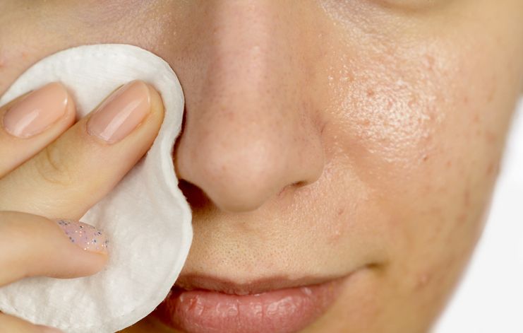 Begini cara mengecilkan pori-pori wajah yang besar, mulai dari memperhatikan kandungan skincare sampai mengatasi kulit kendur.