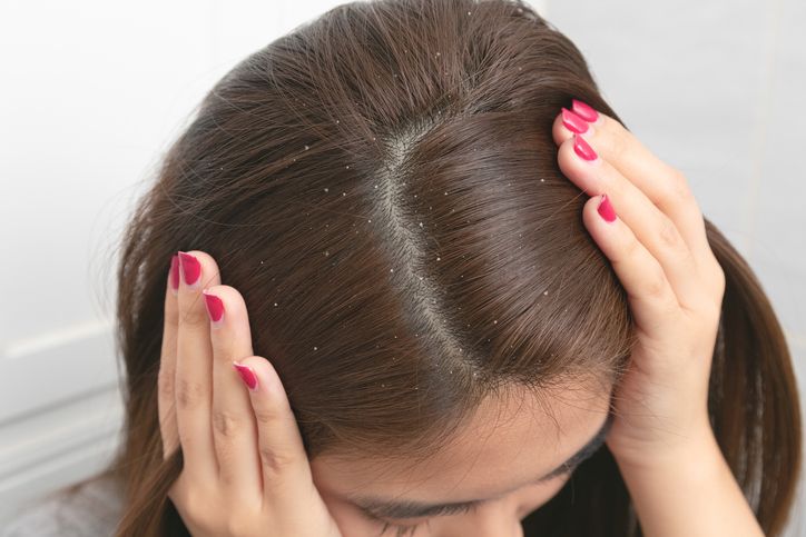 Untuk menguatkan batang rambut dan menyehatkan kulit kepala, kamu perlu menggunakan hair care yang tepat. Ini rekomendasi produknya.