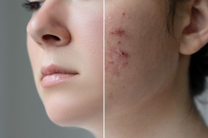 Fluktuasi hormon bisa berpengaruh pada perubahan penampilan, mulai dari kulit hingga berat badan. Simak penjelasan ahli!