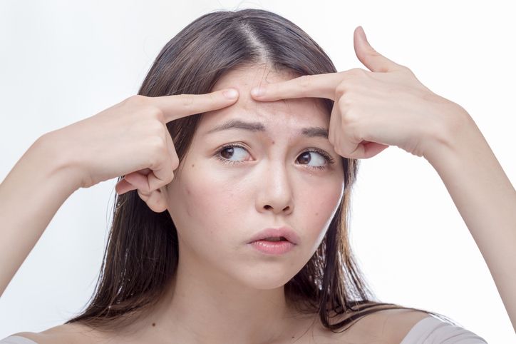 Ternyata stres bisa memicu maupun memperparah munculnya jerawat. Pahami informasi ini agar tahu cara mengatasinya!