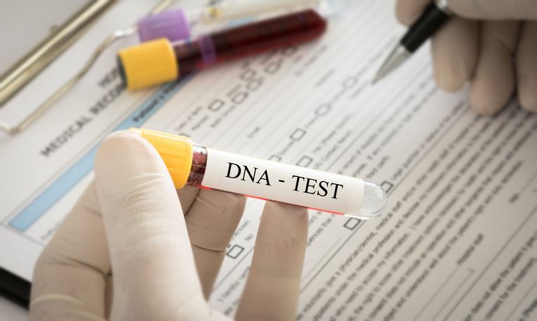 Ramai tes DNA melibatkan Ridwan Kamil dan Lisa Mariana, apa itu? Yuk, kenali serba-serbi tes DNA yang bukan cuma untuk tes genetik.