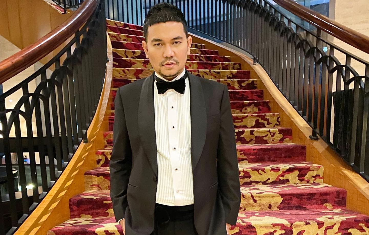 Ada Indra Bekti, lima artis ini pernah mengalami pendarahan otak. Siapa saja artis tersebut? Simak selengkapnya!