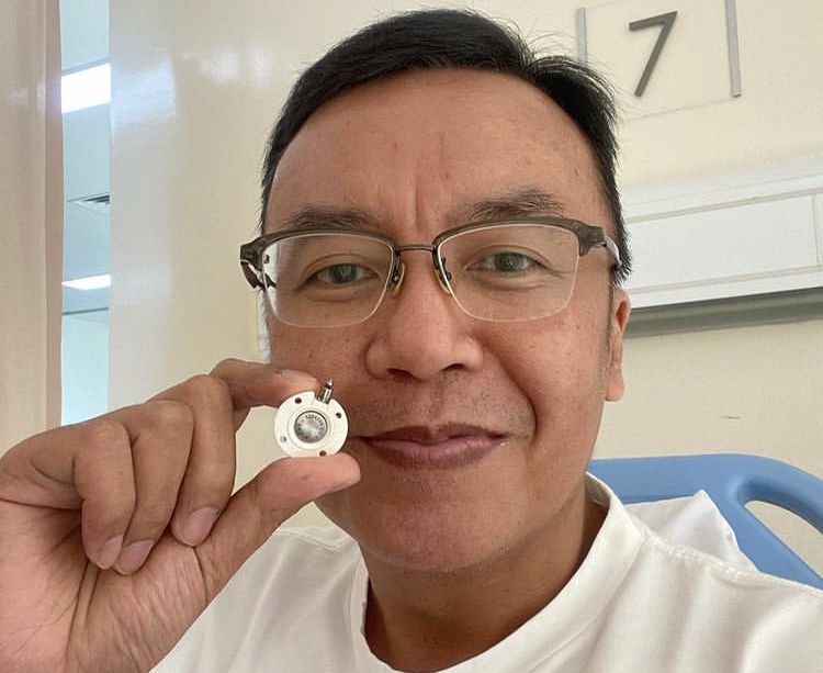 Pasca jalani operasi kecil, penyanyi Ari Lasso umumkan jika proses pengobatan telah berakhir dan tulis pesan ini.