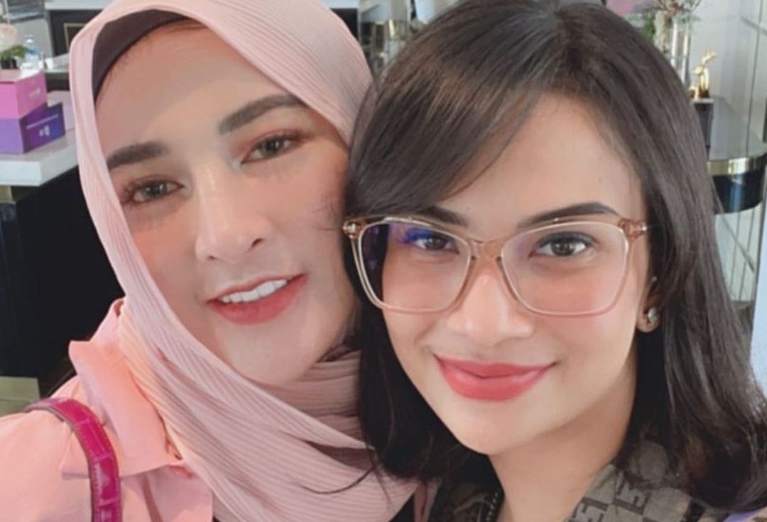 Shandy Purnamasari yang dekat Vanessa Angel dan Bibi Andriansyah mengaku siap jadi orang tua asuh Gala Sky. Asalkan, pihak keluarga mereka berkenan.