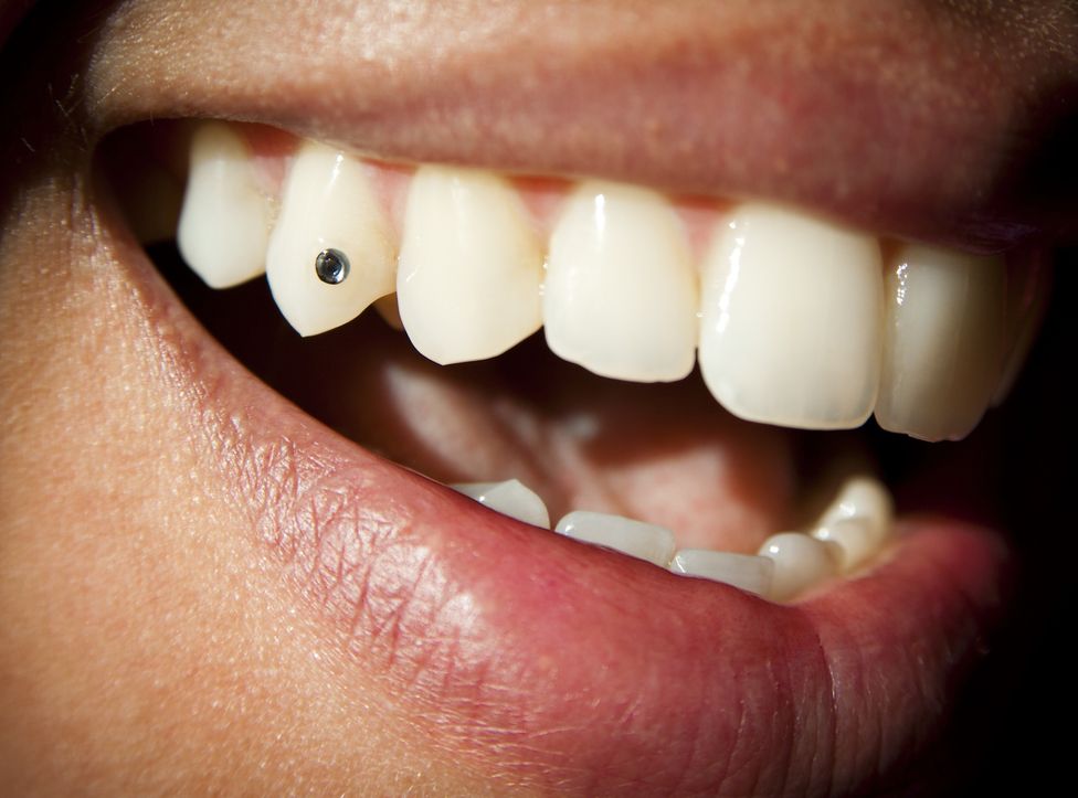 Berikut ini penjelasan dokter ahli mengenai apa itu tooth gem, suatu tren kecantikan yang sedang viral di TikTok.