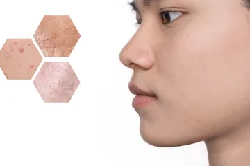 Skin barrier jadi fokus tren kecantikan di 2023