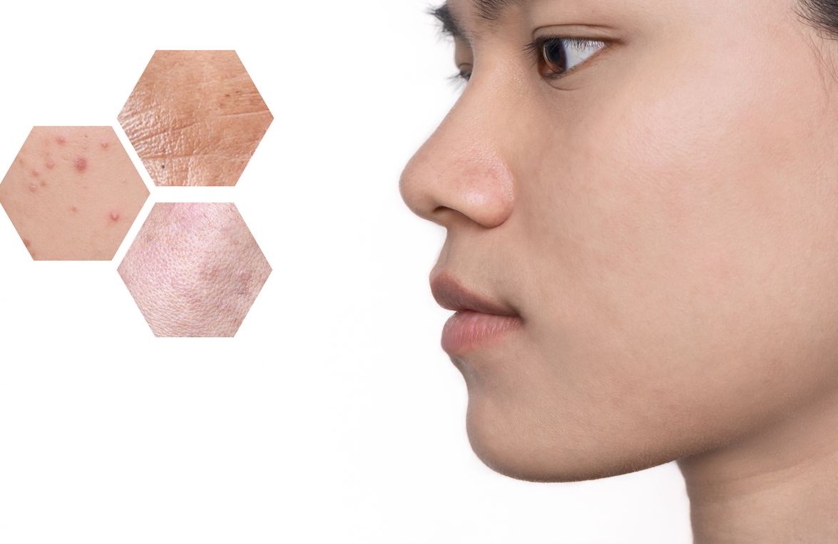 Skin barrier menjadi fokus tren kecantikan di Tahun 2023, didukung dengan adanya hybrid cosmetic, simak ulasan lengkapnya