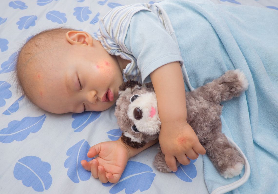 Gigitan nyamuk dapat menimbulkan rasa gatal pada bayi sekaligus membuatnya menangis. Simak, berikut cara mudah melindungi bayi dari gigitan nyamuk!