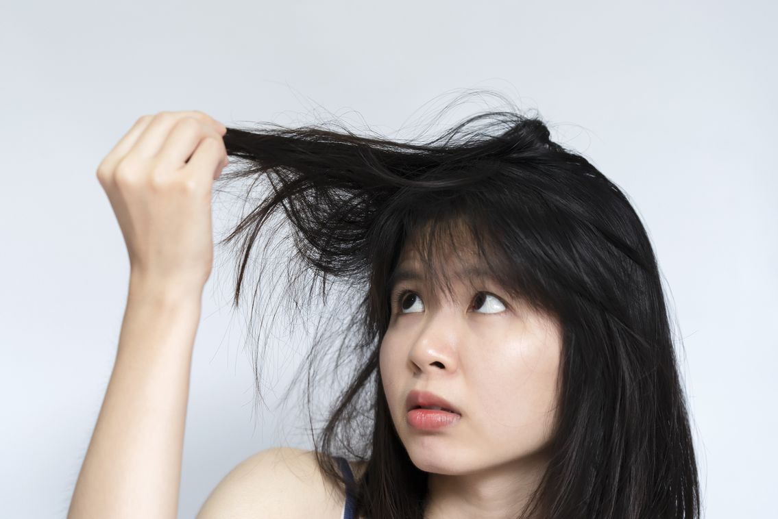 Rambut lepek buat perempuan jadi kurang percaya diri. Untuk itu, yuk cobain berbagai cara mengatasi rambut lepek berikut ini!