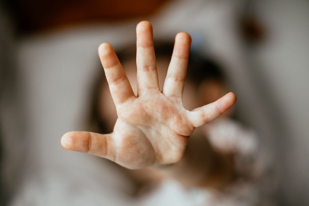 Kekerasan berbasis gender menjadi hal yang menimbulkan keresahan terutama pada perempuan. Simak apa saja dampaknya!