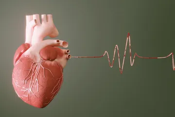Faktor risiko serangan jantung