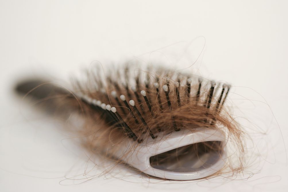 Berikut ini 3 tips membersihkan sisir yang tepat agar kesehatan kulit kepala terjaga dan tak ada kutu rambut.