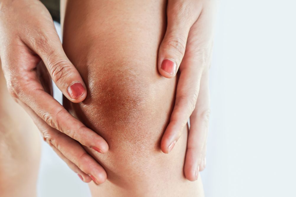Berikut ini 3 tips merawat lutut kaki agar tampilannya tak terlihat tua dan gelap. Termasuk juga rekomendasi produknya