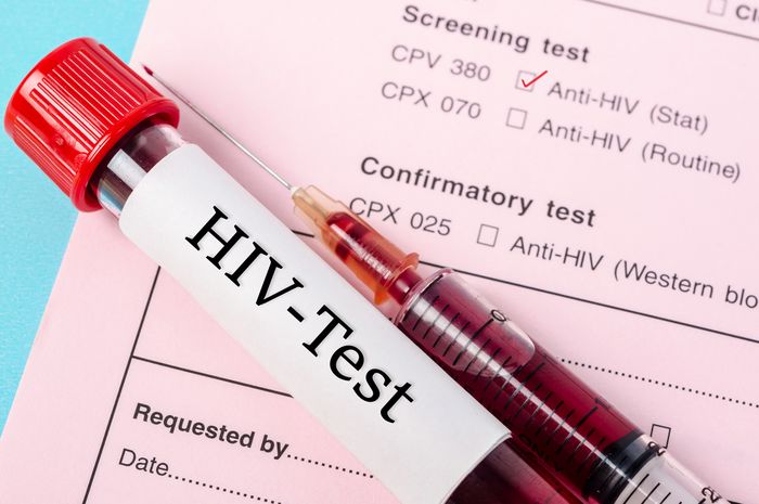 Jelang Hari AIDS Sedunia 2022, Ini Cara Penularan HIV yang Penting ...