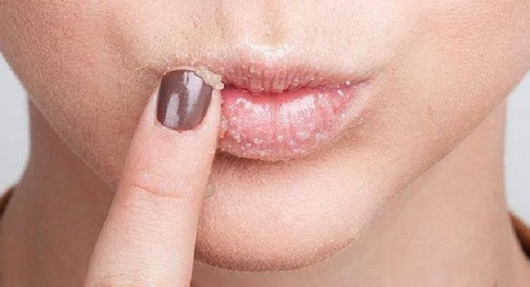 5 Rekomendasi Lip Scrub Untuk Atasi Bibir Kering Saat Berpuasa Parapuan